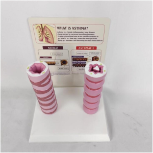 Medical Science Teaching Model PVC Normal VS Asthmatic Trachea Comparison Model for Respiratory Education