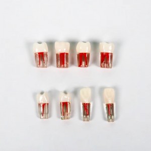 Advanced Dental Root Canal Model for Effective Endodontic Training and Resin Teeth Replacement RCT Practice Replace Resin Teeth