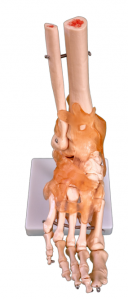 Prirodzený väzivový model kĺbového pásu bigfoot