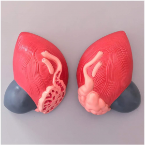 Enlarging human bladder model for medical teaching