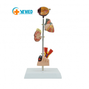 Medical Science Diabetic Foot Anatomical Model Show Patterns of Diabetes Including Pathological Organ Patterns
