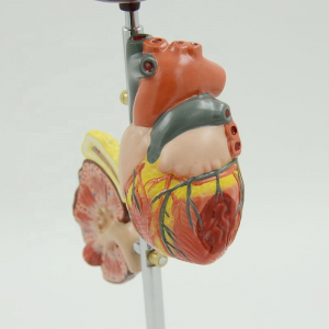 Medical Science Diabetic Foot Anatomical Model Show Patterns of Diabetes Including Pathological Organ Patterns