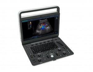 Ultrasound Scanner Digital Ultrasonic Echography Machine Portable Ultrasound No reviews yet