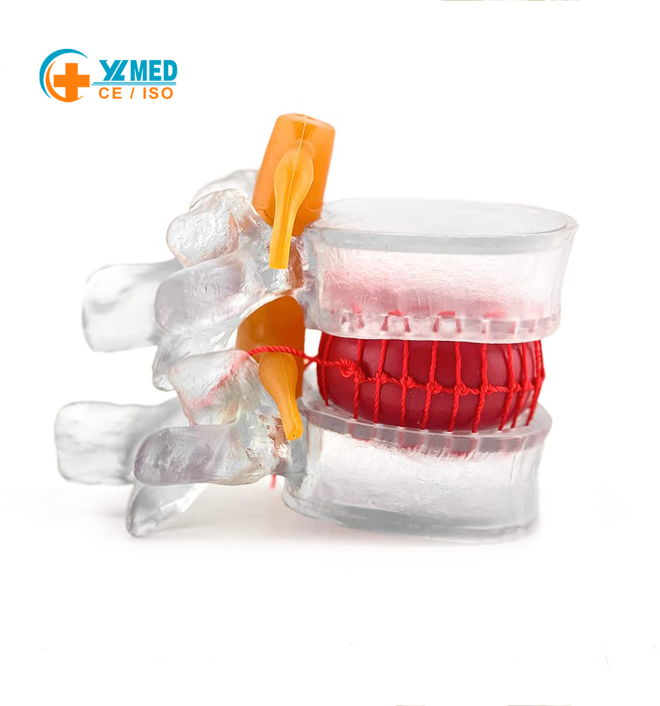 Human Transparent Lumbar Spine 1.5 Times Spine for Student Demonstration Lumbar Disc Protrusion Bone CE/ISO Certification