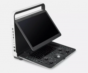 Ultrasound Scanner Digital Ultrasonic Echography Machine Portable Ultrasound No reviews yet