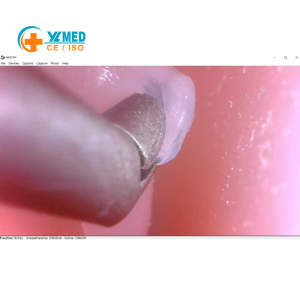Neuroendoscopy Practice Simulator, Craniofacial Anatomical Model for Medical Instruction & Surgical Drills