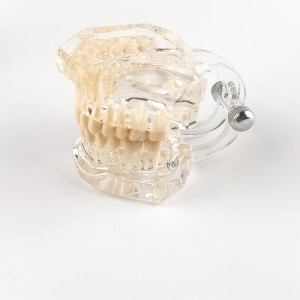 Color dental pathology models Dental restoration pathology dental models with removable teeth and dental implants