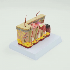 3D PVC Burn Skin Stereoscopic Anatomical Model Medical Human Skin Structure Teaching Injury Burn Comparison Model YULIN Medical