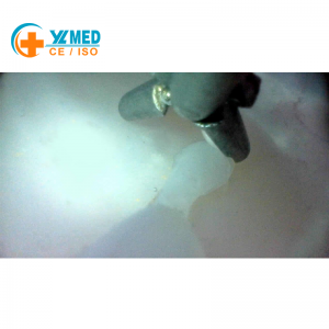 Ureteroscopy Simulation Training Model – Urinary Tract Endoscopy Practice Tool for Medical Education