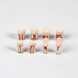 Advanced Dental Root Canal Model for Effective Endodontic Training and Resin Teeth Replacement RCT Practice Replace Resin Teeth
