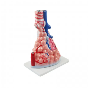 Alveolar enlargement model