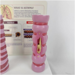 Medical Science Teaching Model PVC Normal VS Asthmatic Trachea Comparison Model for Respiratory Education