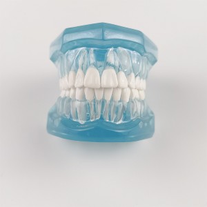 Color dental pathology models Dental restoration pathology dental models with removable teeth and dental implants