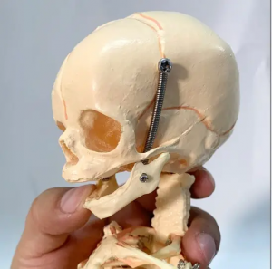 37cm Imodeli Yesikelethoni Sengane Yesibeletho Esinezigebhezi Ezimbili I-Anatomical Demonstration Yesayensi Yezokwelapha Yengane