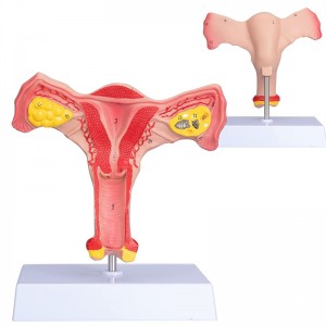 Anatomical model of female uterus with ovary