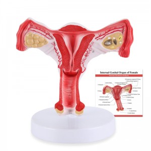 Anatomysk model fan froulike uterus mei eierstok