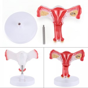 Modèle anatomique de l'utérus féminin avec ovaire