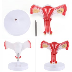 Anatomical model of female uterus with ovary