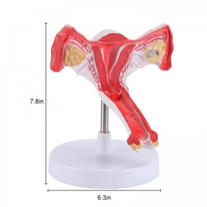 Model anatomi uterus wanita kanthi ovarium