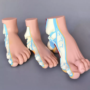 Medical science teaching demonstration anatomy human pathological foot anatomy Flatfoot high arched foot model