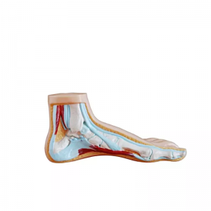 Medical science teaching demonstration anatomy human pathological foot anatomy Flatfoot high arched foot model