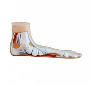 Medical science teaching demonstration anatomy human pathological foot anatomy Flatfoot high arched foot model