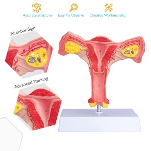 Factory Support Customization Medical Gynaecology Female Ovarian Reproductive Structure Ovary Uterus Model