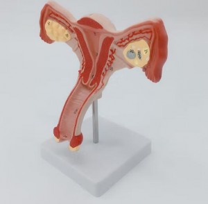 Factory Support Customization Medical Gynaecology Female Ovarian Reproductive Structure Ovary Uterus Model