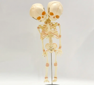 Deforme olmuş çift kafalı fetal iskelet modelinin gösteri modelinin öğretilmesi