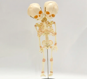 Teaching demonstration model of deformed double head fetal skeleton model