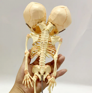Výukový demonstrační model modelu deformované dvouhlavé kostry plodu