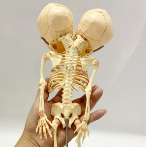 Chiwonetsero chophunzitsira cha mawonekedwe opunduka mutu wa fetal skeleton model