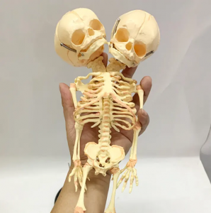 Učebný demonštračný model deformovaného modelu kostry plodu s dvojitou hlavou