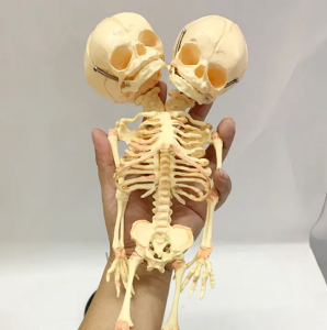 Pagtuturo ng demonstration model ng deformed double head fetal skeleton model