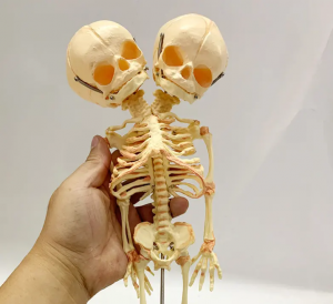 Výukový demonstrační model modelu deformované dvouhlavé kostry plodu