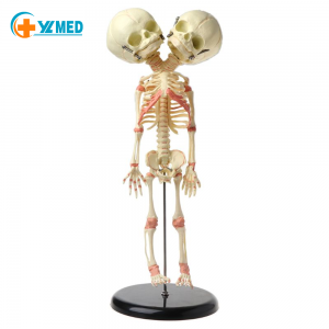 Teaching demonstration model of deformed double head fetal skeleton model