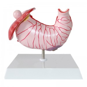 Clinic Display Medical School Anatomical Model Human Gastric Lesion Model Anatomy Pathological Stomach Model