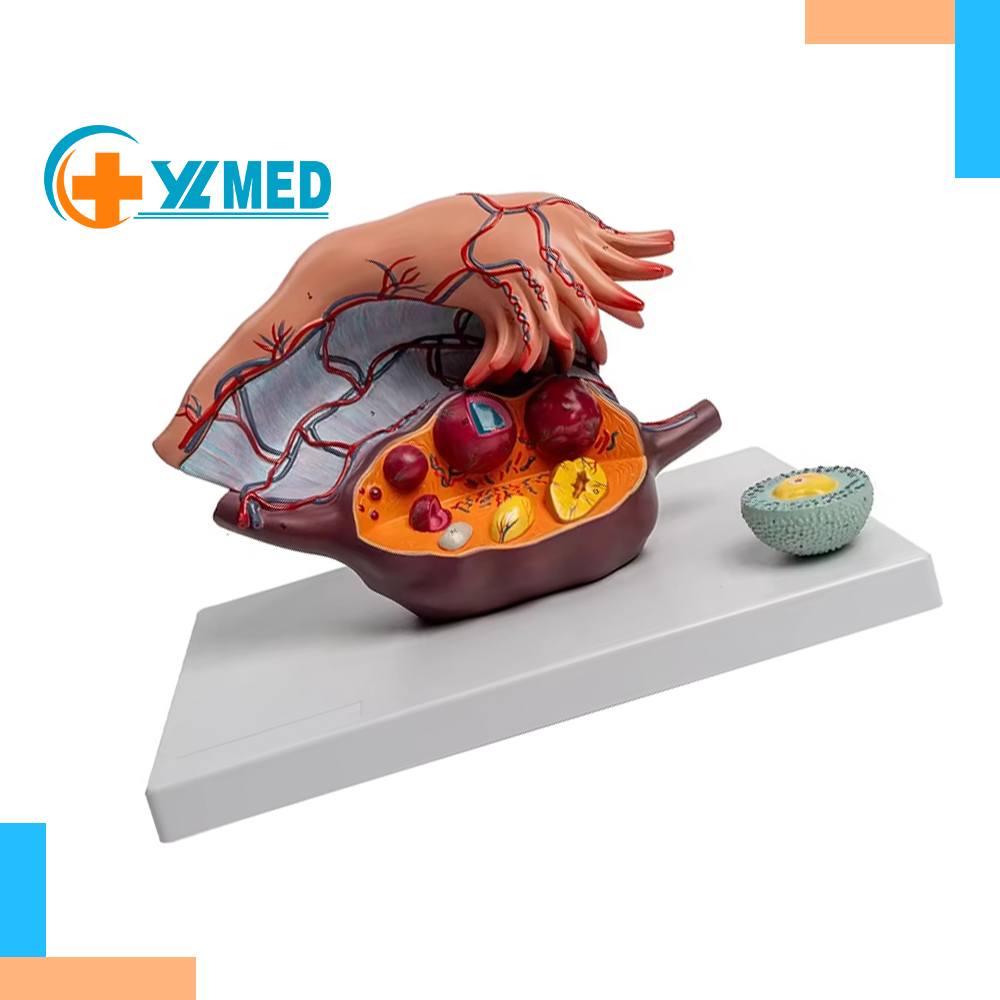 Anatomical Model of Female Uterus Ovary & Oviduct Umbrella for Follicular Development-Enlarged Medical Science Product
