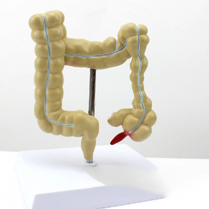 Medical College Gastroenterology Display Model Human Colonic Disease Model Large Intestine Pathological Model