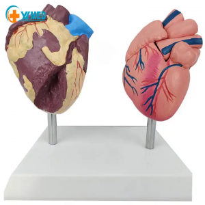 Human Anatomy Heart Model 2parts PVC teaching models Heart health and sick compare heart model