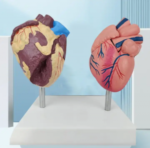 Human Anatomy Heart Model 2parts PVC teaching models Heart health and sick compare heart model