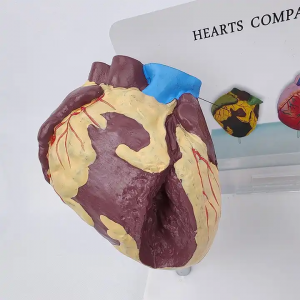 Human Anatomy Heart Model 2parts PVC teaching models Heart health and sick compare heart model