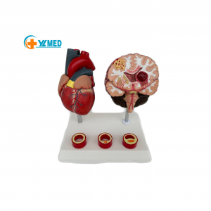 Human Anatomy Heart Vessels and Brain Pathological Structure Cerebral Vascular Disease Model YL2-30082 Size 3 Non-Electric