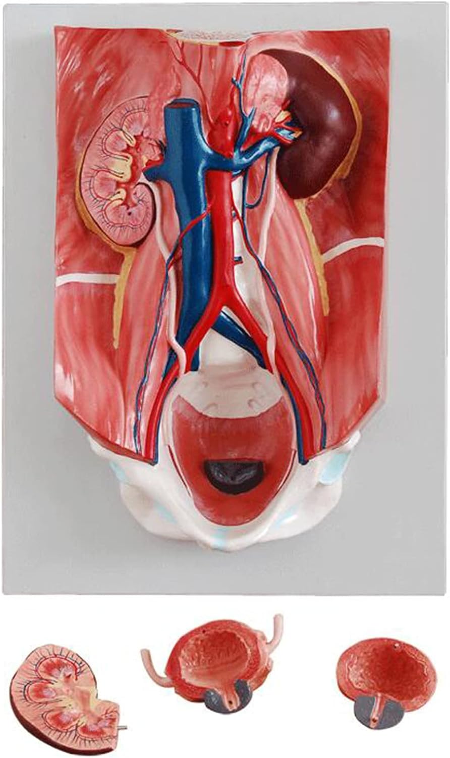 Tib neeg Urinary System Model - Tib Neeg Vesicoureteral Vascular Teaching Model - Raum Lub Cev Lub Cev Cov Qauv Anatomy rau Kev Kawm Kho Mob thiab Kev Kawm