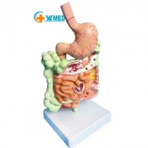 Removable Teaching Model Human Stomach Anatomy Model Pathological Digestive System ModelStomach Section Model