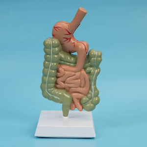 Removable Teaching Model Human Stomach Anatomy Model Pathological Digestive System ModelStomach Section Model