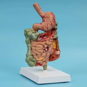 Ihe Nlereanya nkuzi mbughari nke afọ mmadụ Anatomi Model Pathological Digestive System Model Model Akụkụ afọ