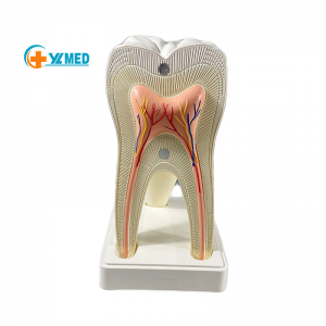 Enlarged Model Display Human Anatomy Model Biology Teaching Medical Science 2 Parts Molar Tooth Decay Molar Model