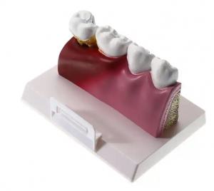 Dental student jaw model teaching tooth models for dentistry student teeth model