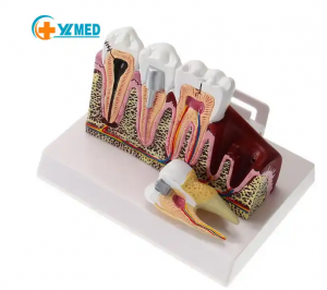 Dental student jaw model teaching tooth models for dentistry student teeth model